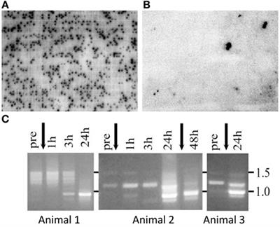 The SpTransformer Gene Family (Formerly Sp185/333) in the Purple Sea Urchin and the Functional Diversity of the Anti-Pathogen rSpTransformer-E1 Protein